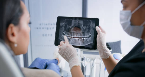 Licensed Dental Veneers service in Holly Springs, NC - Smile Center Dentistry